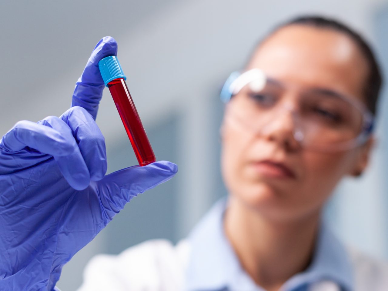 Profissional da saúde em laboratório segurando frasco de plástico com sangue de exame.