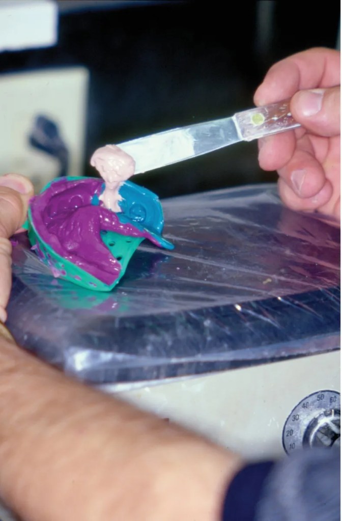 Aplicando gesso em molde odontológico.