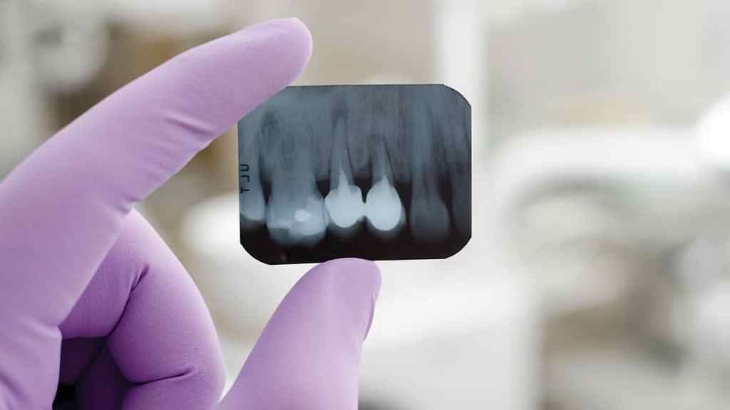 Dentista de luva lilás segurando raio-x.