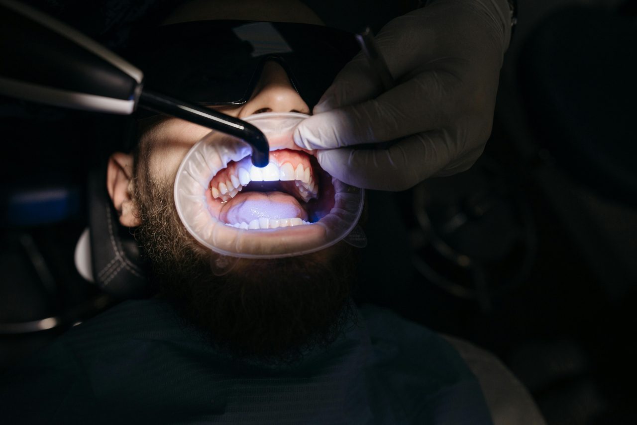 Dentista realizando clareamento com luz azul.