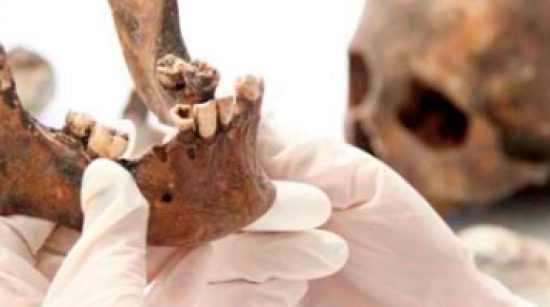 pessoa usando luvas segurando crânio e analisando dentes