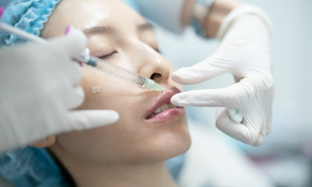 Aplicando ácido hialurônico na boca da paciente.