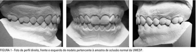 Moldes de arcada dentária ideal, ou seja, oclusões normais.
