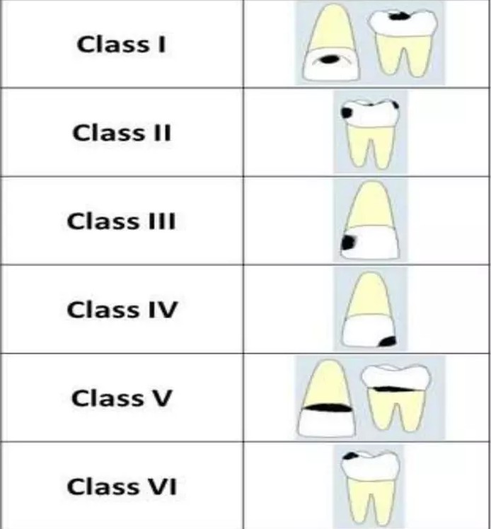 Desenhos mostram diferenças da classificação de black