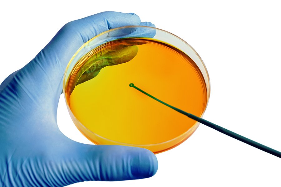 Fazendo cultura microbiológica em pote