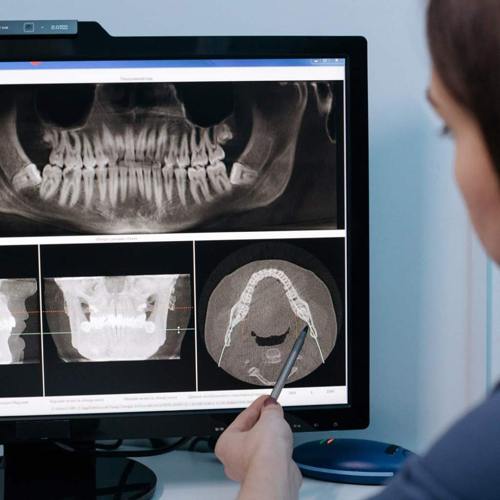 Dentista olhando raio-x em tela de computador.