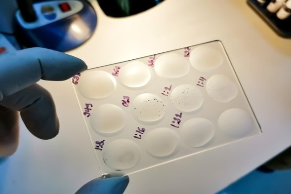 Realizando Testes não treponêmicos, está segurando uma lâmina de vidro com os produtos reagindo.