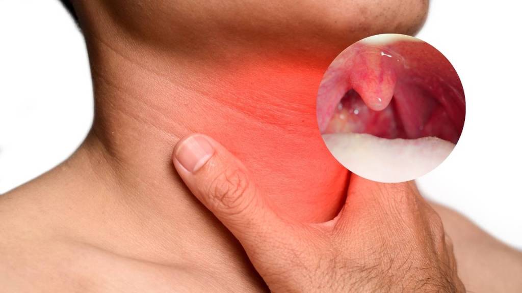 Homem com a mão no pescoço. Na imagem colocaram uma luz vermelha e uma imgem da boca para indicar um Abscesso parafaríngeo.