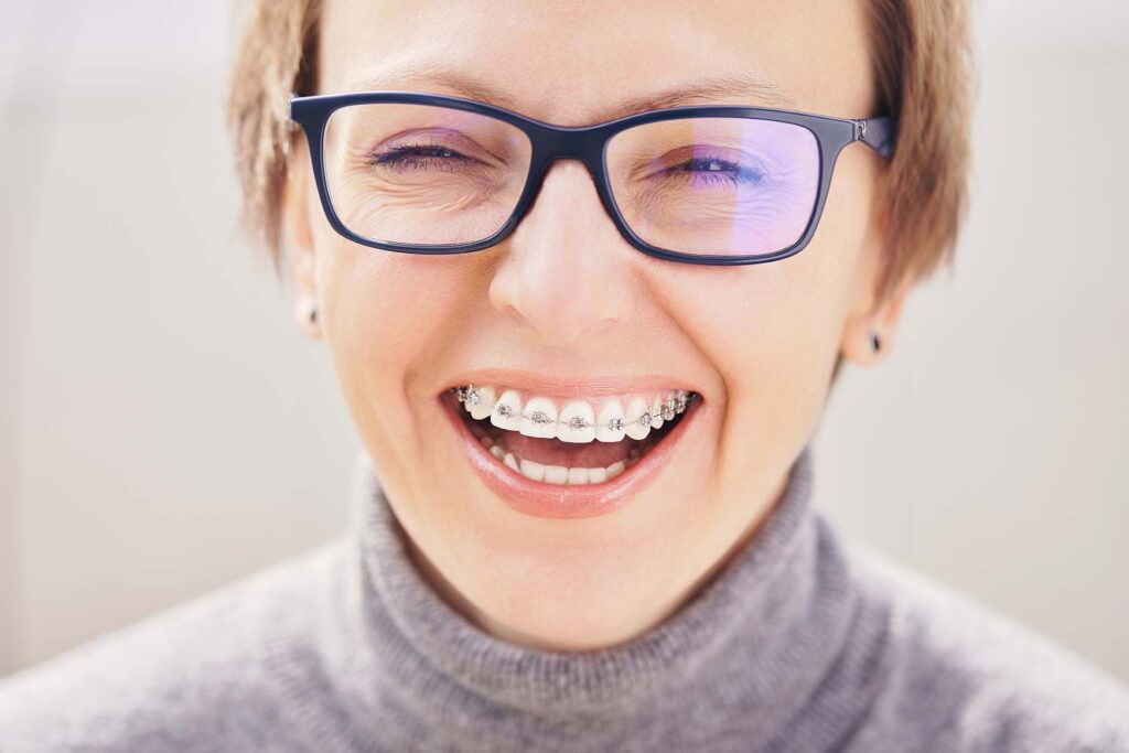 Senhora usando aparelho dental
