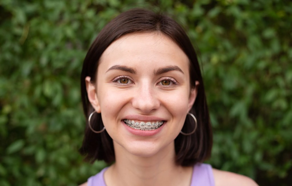 Moça sorrindo usando aparelho dental.
