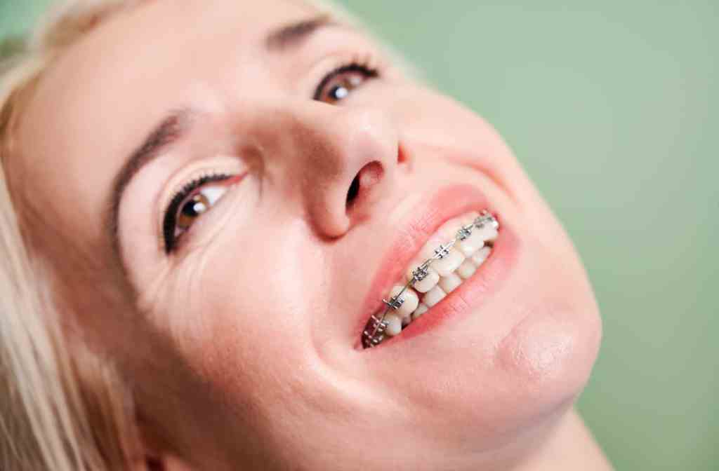 Senhora usando aparelho dental, está no dentista