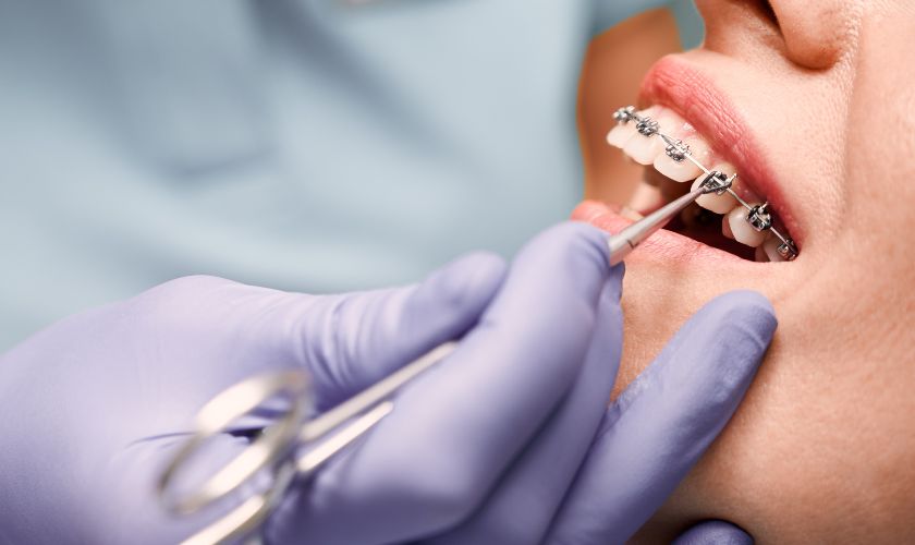 Dentista fazendo manutenção ortodôntica