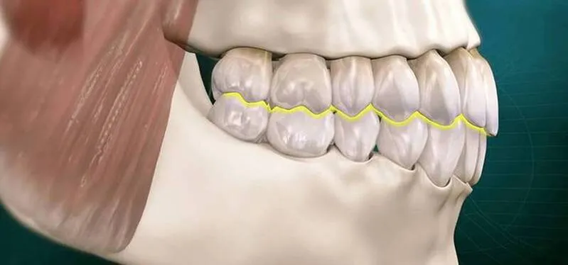Desenho mostra crânio com dentes com oclusão.