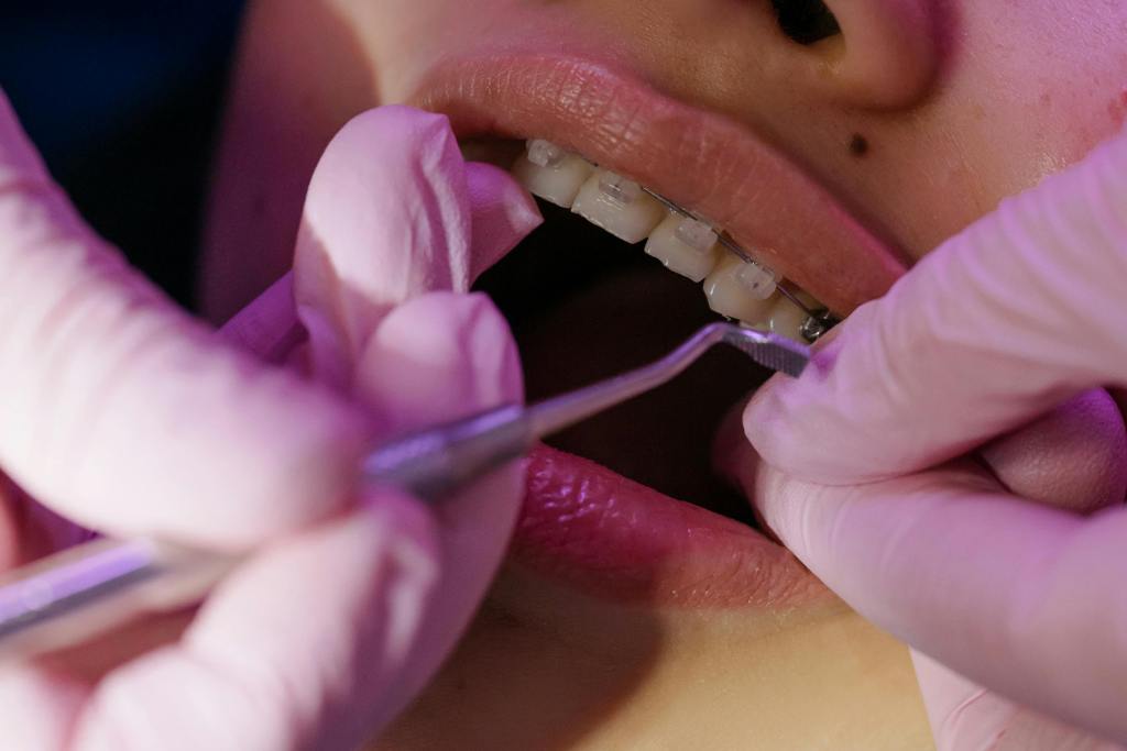 Dentista ajustando aparelho da paciente.